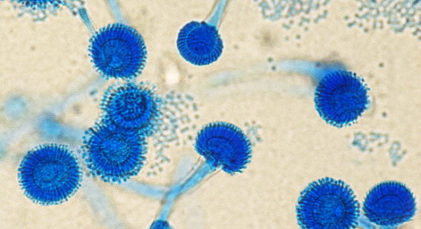 aspergillus
